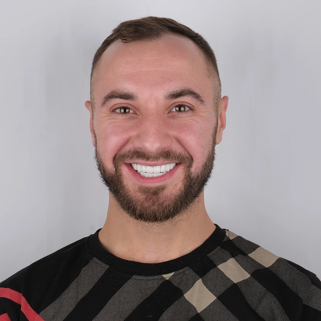 Smile Gallery